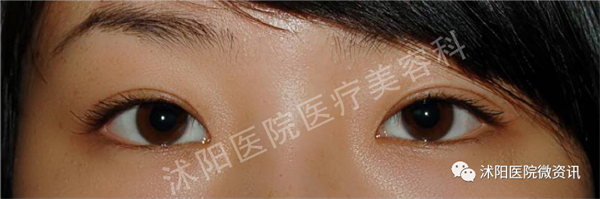 640 (1)_副本2.png