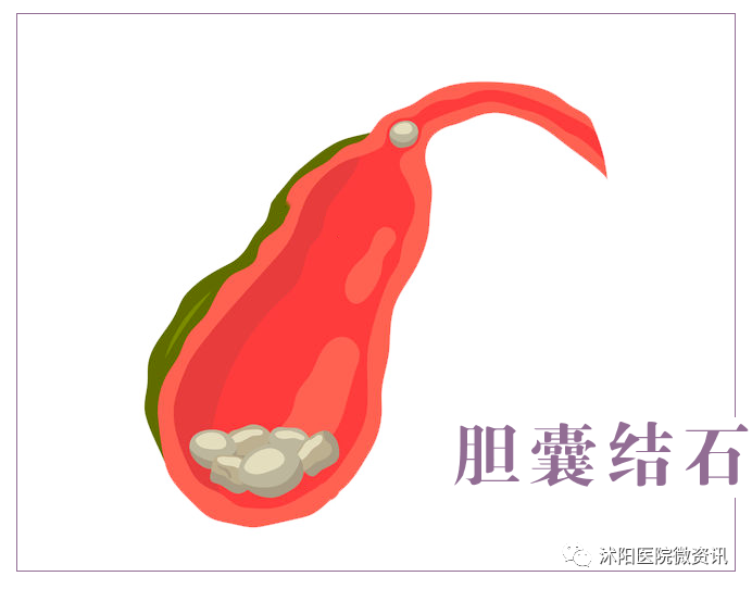 1679622554806612.png