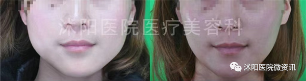 微信图片_20230329122815.png