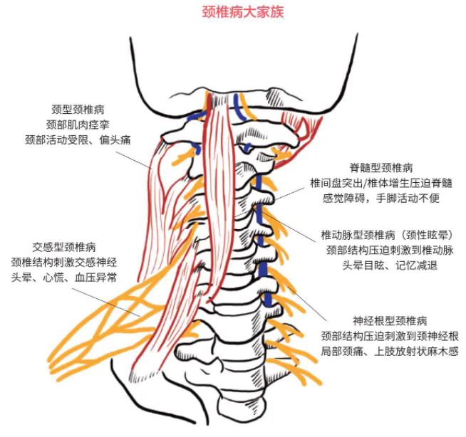 640.webp (3).png